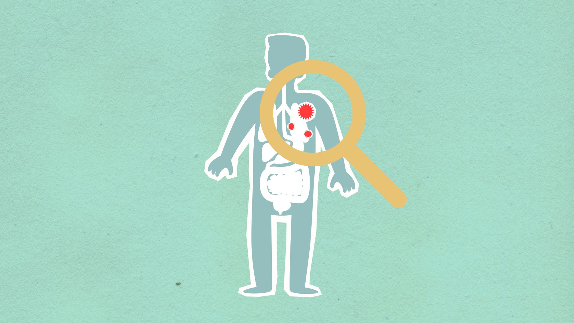 Agent-Native Immune System: Architecture, Taxonomy, and Engineering