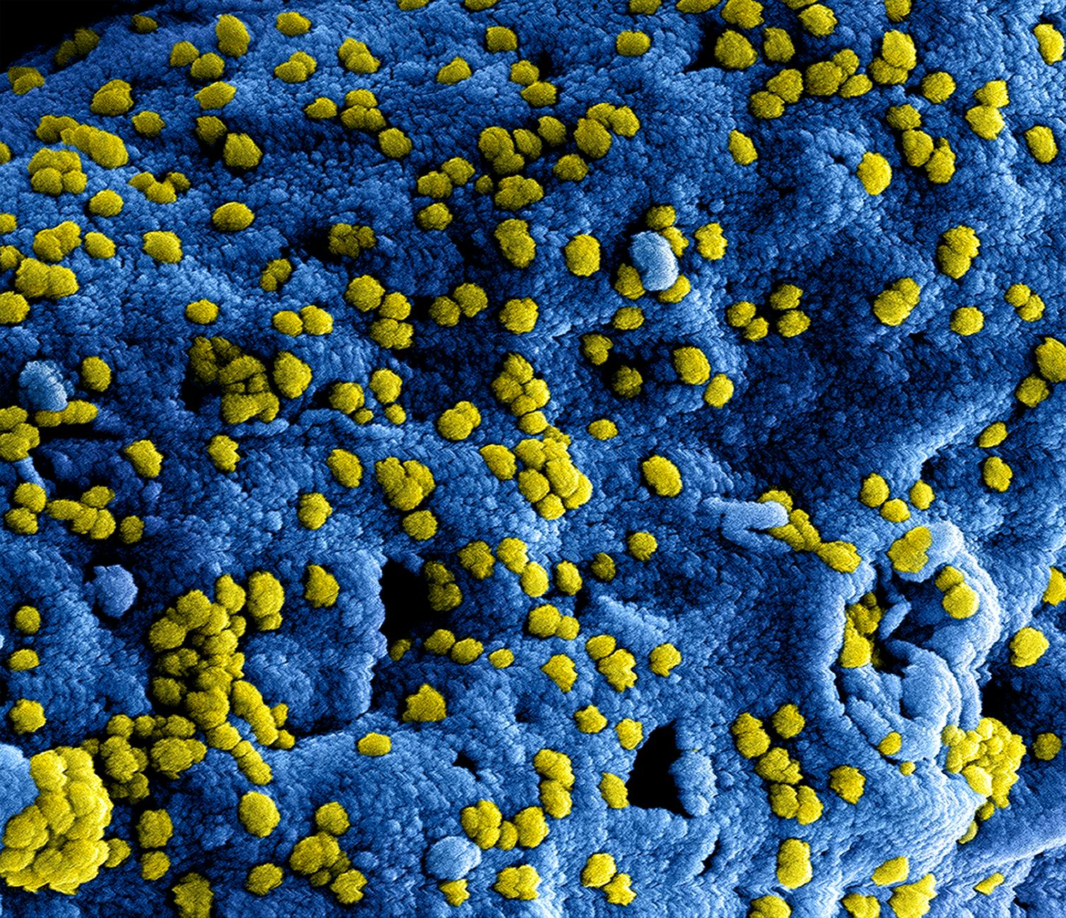 Prospective multi-pathogen disease forecasting using autonomous LLM-guided tree search