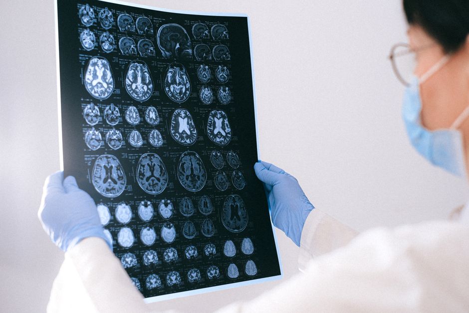 Meta's brain-scanning system reads sentences non-invasively, code open source