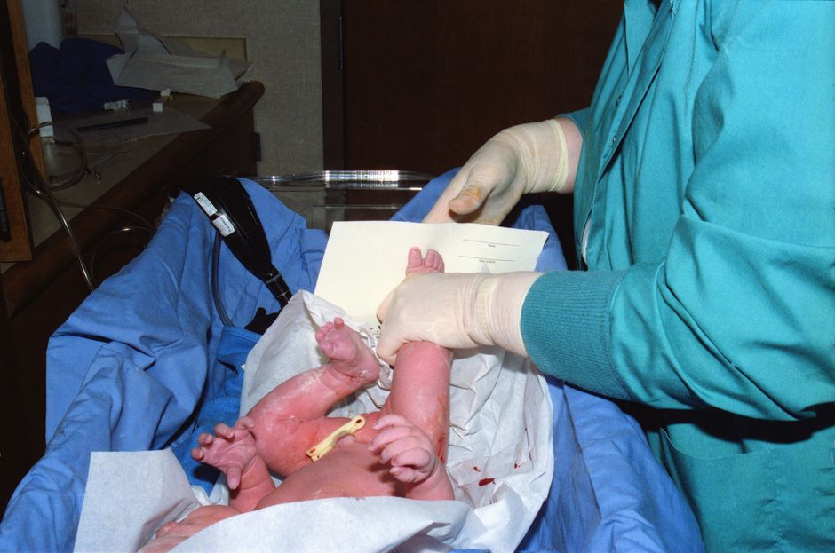Sangue do cordão umbilical vira 'arma' contra o câncer em novo estudo