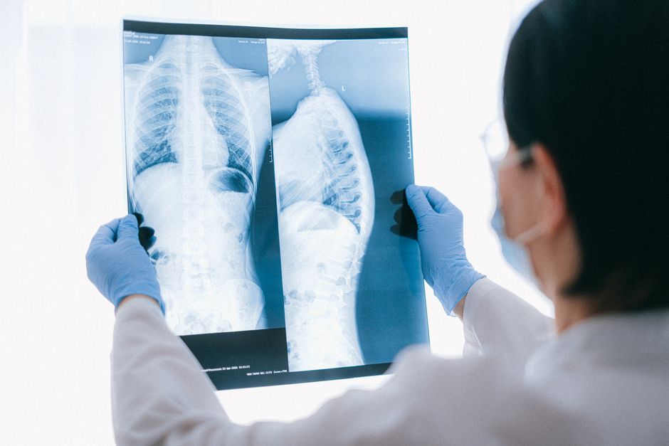Phase 2b Study of a Respiratory Syncytial Virus and Human Metapneumovirus (RSV+HMPV) Protein Vaccine Candidate in Adults 60 Years of Age and Older