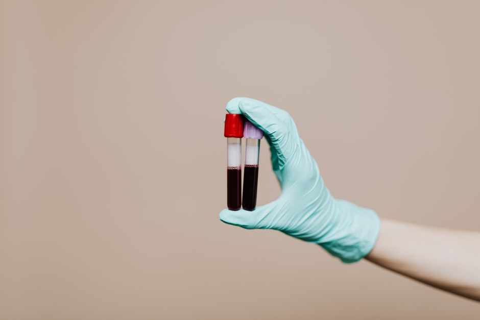 Novo exame de sangue que detecta sinais de 50 tipos de câncer chega ao Brasil